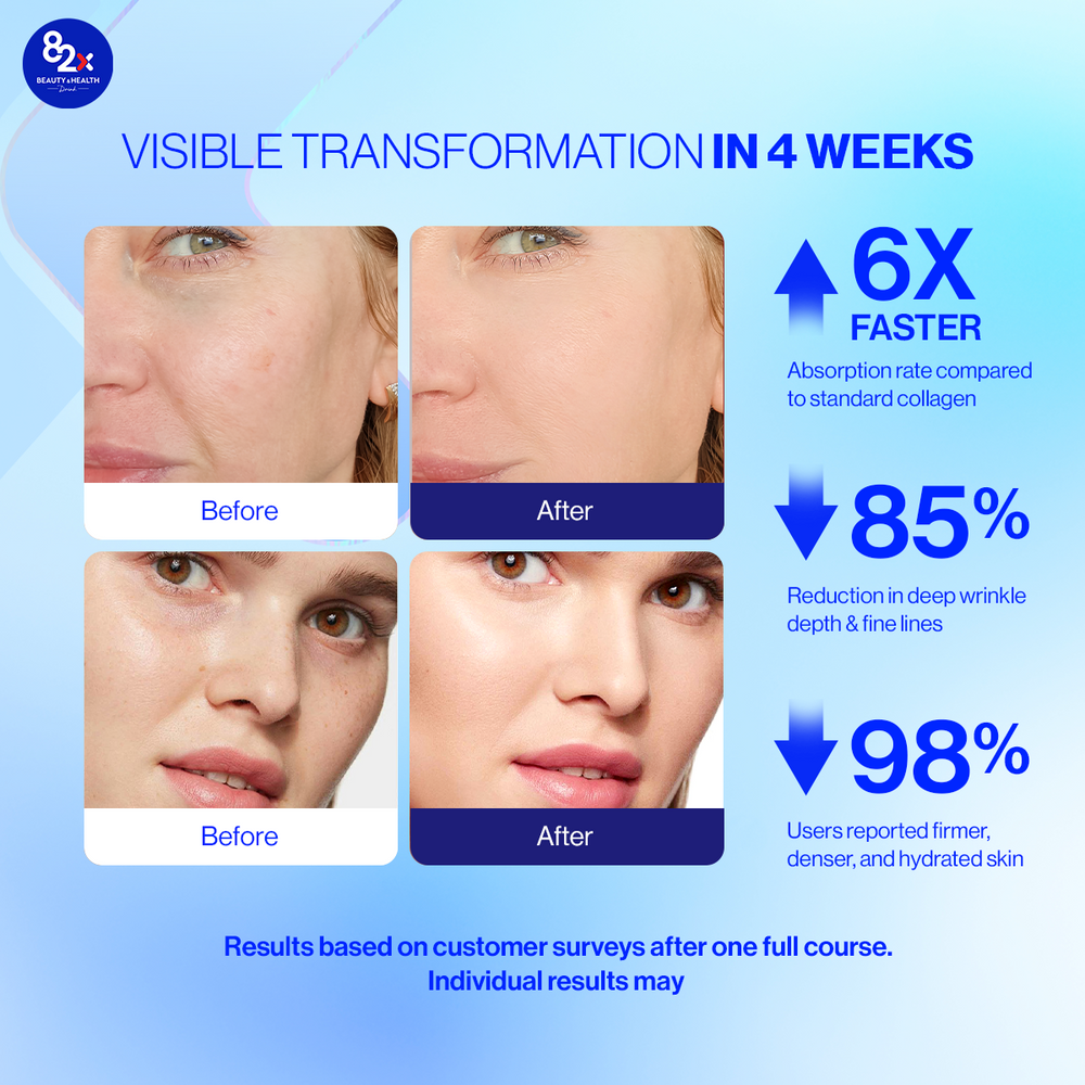 
                  
                    Thực Phẩm Bảo Vệ Sức Khoẻ Collagen 82X 120000 Stem Cell
                  
                